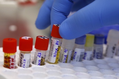 Zikavirus